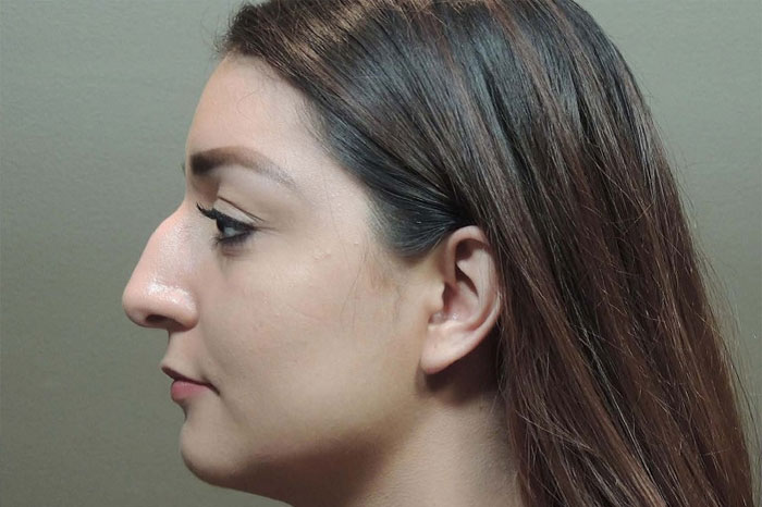 Đặc điểm nhận dạng mũi khoằm