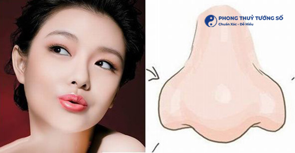 Một số cách khắc phục dáng mũi hình củ tỏi