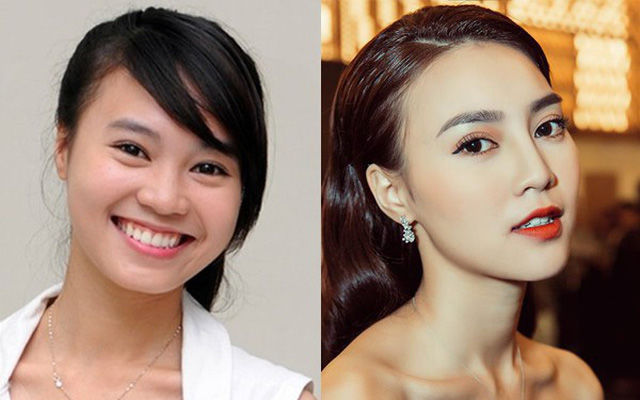 Ninh Dương Lan Ngọc càng thêm quyến rũ nhờ nâng mũi