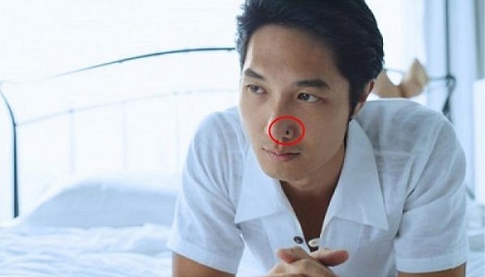 Nốt ruồi ở mũi nam có tướng số như thế nào?