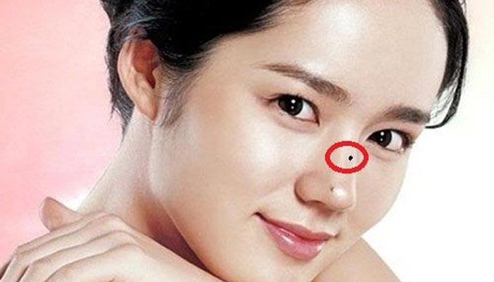 Nốt Ruồi Trên Sống Mũi Có ý Nghĩa Gì?