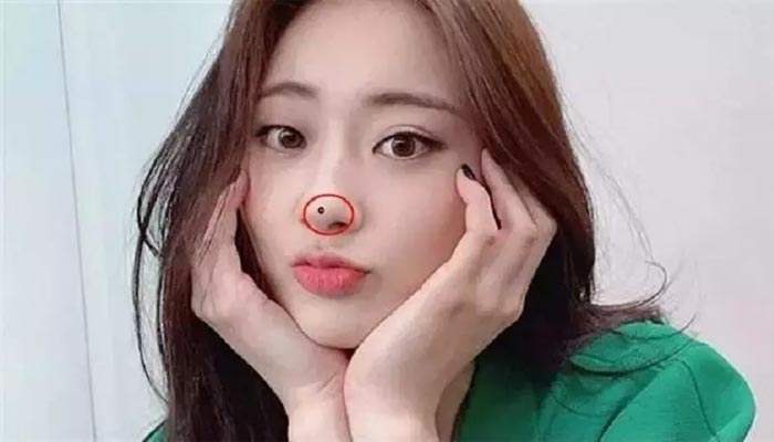 Nốt ruồi ngay đầu mũi ảnh hưởng gì đến vận mệnh không?