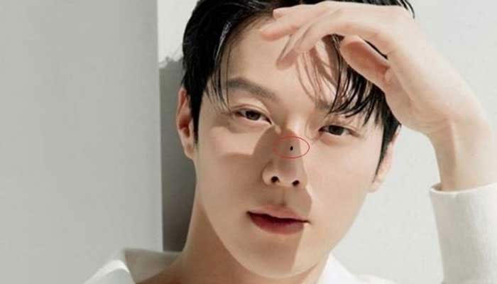 Nốt ruồi trên sống mũi đàn ông tốt hay xấu?