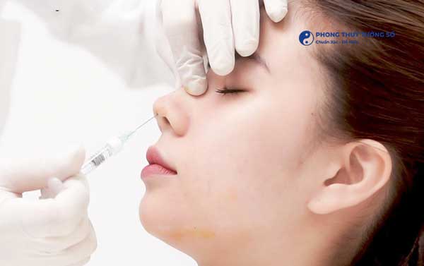 Tiêm filler làm mũi cao