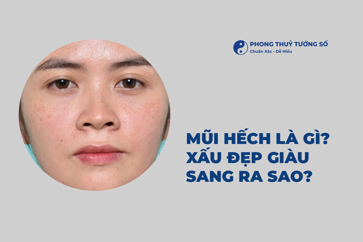 Mũi Hếch Là Gì? Xấu Đẹp Giàu Sang Ra Sao?
