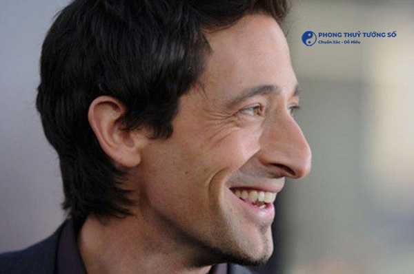 Mũi két thường gặp ở người phương Tây hơn là người Á Đông