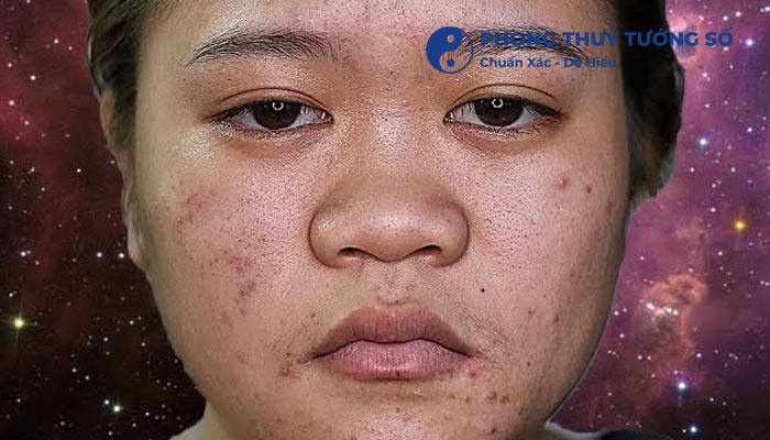 Mũi Tẹt Là Gì? Tướng Số Người Mũi Tẹt Như Thế Nào?