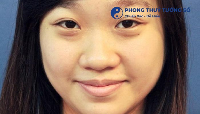 Mũi tẹt xấu hay đẹp?