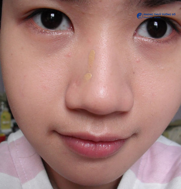 Những phương pháp khắc phục mũi to phổ biến hiện nay