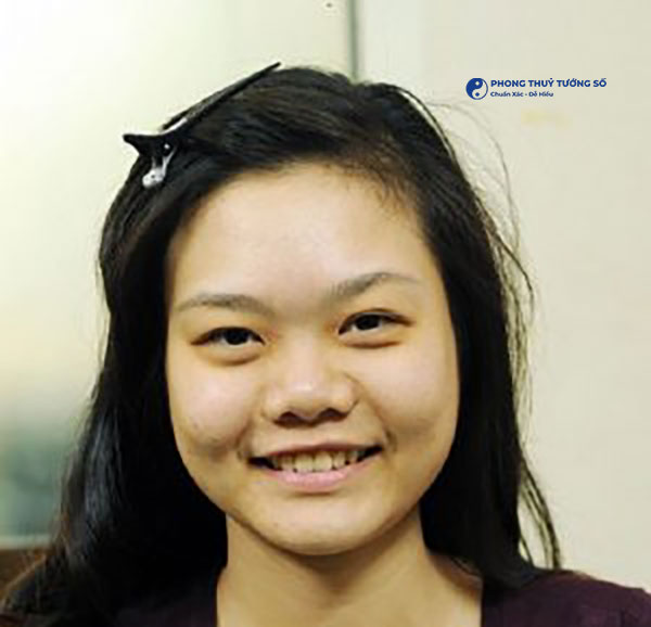 Nguyên nhân hình thành chiếc mũi to