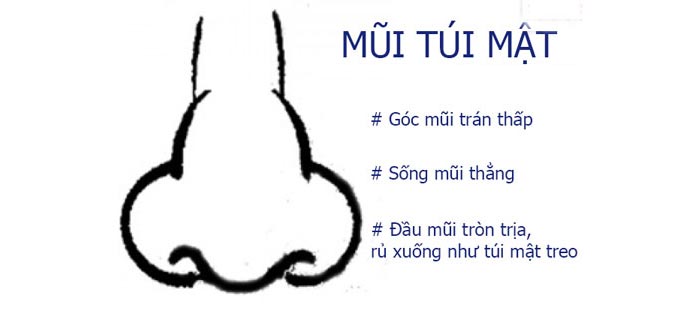 Mũi túi mật treo là như thế nào?