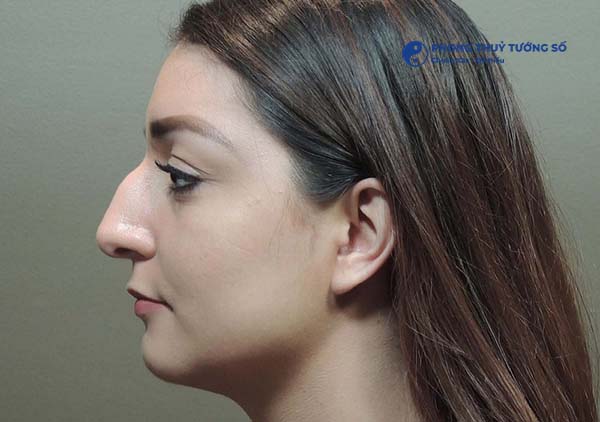 Xem tướng phụ nữ mũi két