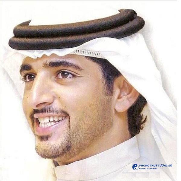 Nên hay không nên sửa mũi diều hâu