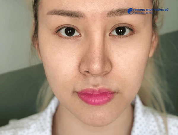 Dáng mũi lệch sống