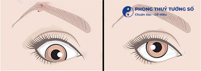 Các kiểu mắt tam bạch