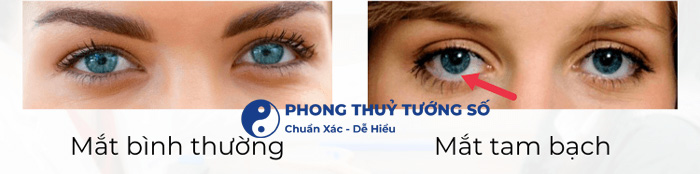 Cách nhận biết mắt tam bạch
