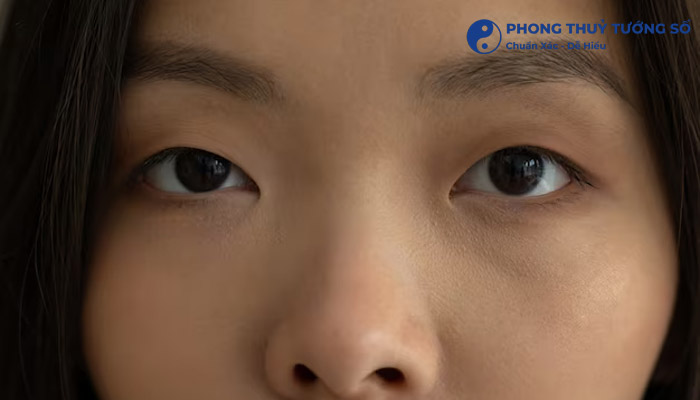 Tổng quan về mắt 1 mí