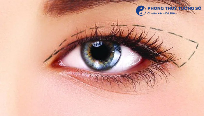 Thẩm mỹ mắt một mí